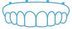 Illustration of an upper All-on-Four denture.